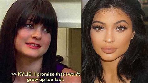 The Changing Face Of Kylie Jenner Before And After Kylie Jenner