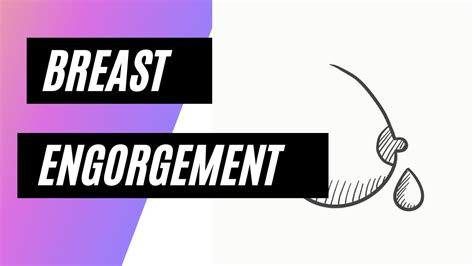 Tips On How To Manage Breast Engorgement YouTube