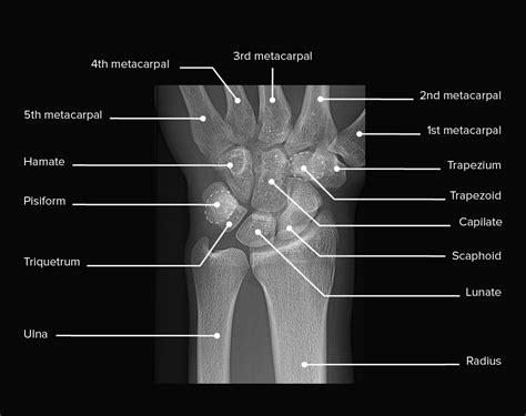 Wrist Joint Anatomy Concise Medical Knowledge