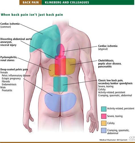 PDF Masquerade Medical Causes Of Back Pain Semantic Scholar