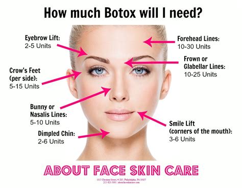 How Much Botox Will I Need Botox Cosmetic Botox Botox Injection Sites