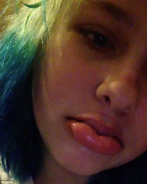 Kylie Jenner Challenge Sees Teens Suck Shot Glasses To Blow Up Their