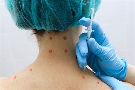 Trigger Point Injections Trigger Point Therapy The Healthy