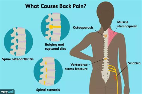 Back Pain Symptoms Causes Solutions Chair Yoga Flowithme