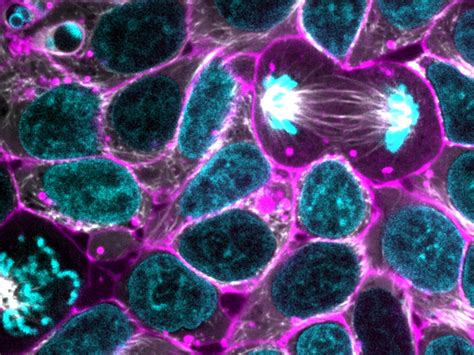 Glowing Human Cells May Shed Light On Sickness And Health Kwbu