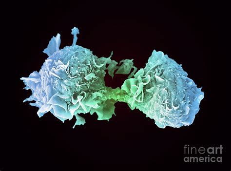 Lung Cancer Cells Dividing Photograph By Anne Weston Francis Crick