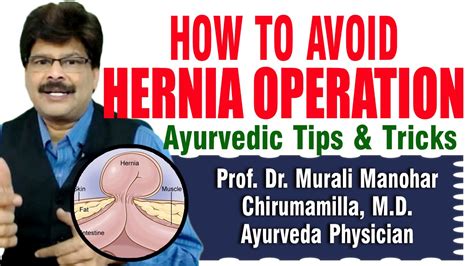 How To Avoid Hernia Operation Prof Dr Murali Manohar Chirumamilla