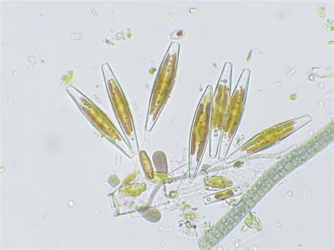 Some Diatoms Rdiatom