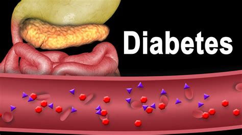 Diabetes Type 1 and Type 2, Animation. - YouTube