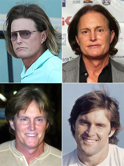 [pics] Bruce Jenner S Plastic Surgery — A Scary Facial Transformation Hollywood Life