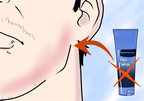How To Prevent Razor Burn 14 Steps With Pictures Wikihow