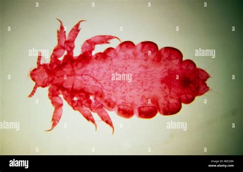 Human Body Louse Light Micrograph Of A Female Of The Human Body Louse