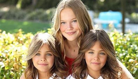 These Twins Were Named “most Beautiful In The World” Wait Till You See Them Today