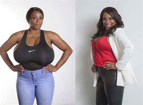 Biggest Natural Breasts In Texas Woman Has Jjj Breast Reduction