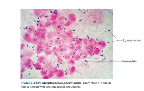 Answered S Pneumoniae Neutrophils Figure 2111 Bartleby