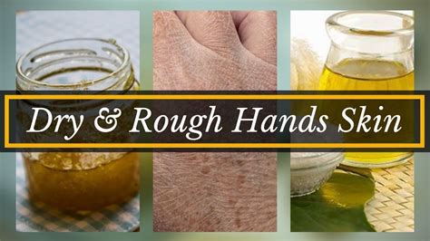How To Moisturize Dry Hands Naturally Dry And Rough Hands Solution
