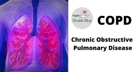 COPD Chronic Obstructive Pulmonary Disease Kajal S Health Blog