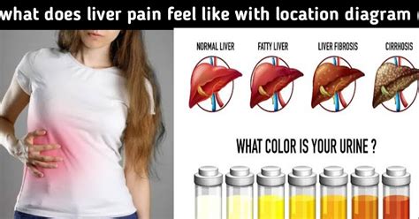 What Does Liver Pain Feel Like With Location Diagram Complete