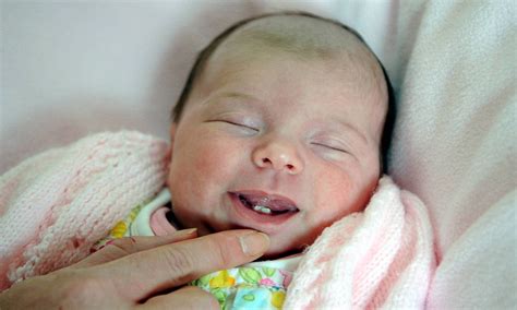 Parents Shock As Smiling Baby Girl Is Born With Two Front Teeth