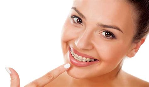 Oral Hygiene Tips For People With Braces Orthodontic Blog