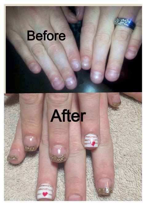 Acrylic Nails Before And After Natural Nails Nail Design Glitter
