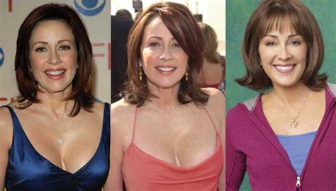 Patricia Heaton Plastic Surgery Before And After Pictures 2021 Never