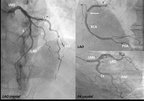 Cardiac Catheterization Medicine