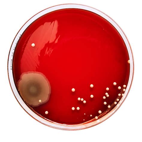 Blood Agar Stock Photos Pictures And Royalty Free Images Istock