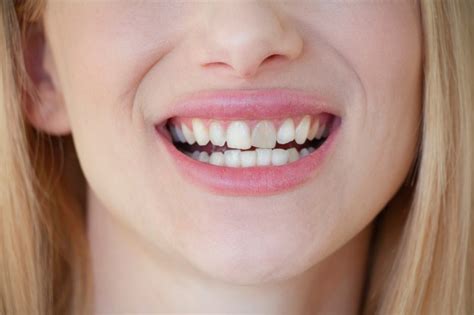 Gray Teeth Treatment Options Smile More Dentistry