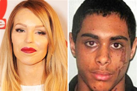 Thug Who Threw Acid At Katie Piper Applies For Parole Daily Star