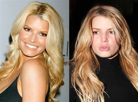 Jessica Simpson From Better Or Worse Celebs Who Have Had Plastic Surgery