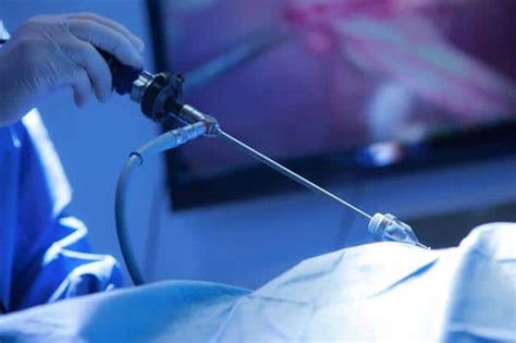 Inguinal Hernia Surgery Scottish Hernia Centre