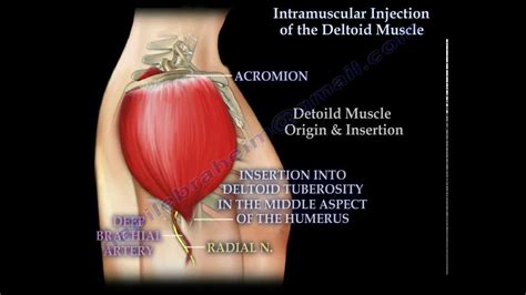 💋 Deltoid Muscle Injection Technique Clinical Guidelines Nursing Intramuscular Injections