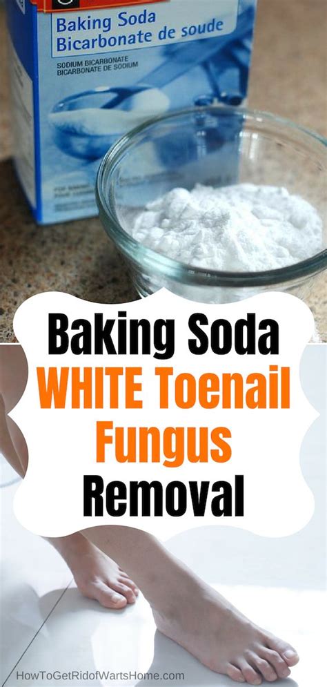 White Toenail Fungus Baking Soda Home Remedy White Toenail Fungus