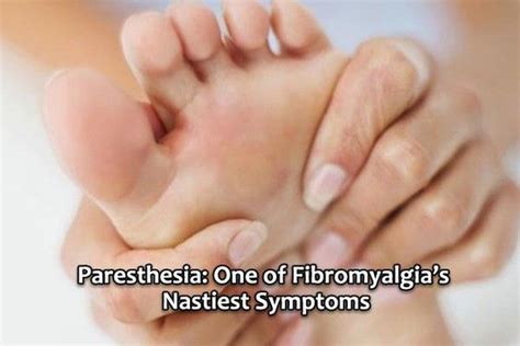 Paresthesia One Of Fibromyalgias Nastiest Symptoms Mortons Neuroma