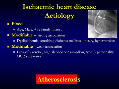 Ppt Ischaemic Heart Disease Clinical Aspects For Dentist Powerpoint Presentation Id 5169453