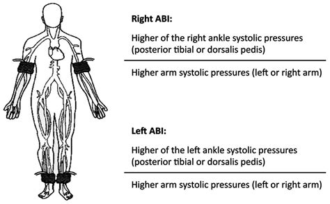 Ankle Brachial Chart
