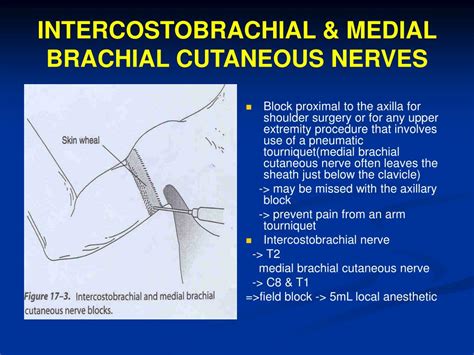 Intercostobrachial Nerve Block