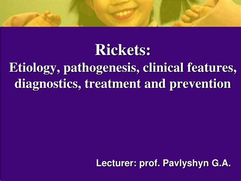 Ppt Rickets Etiology Pathogenesis Clinical Features Diagnostics