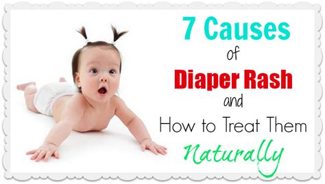 7 Causes Of Diaper Rash And How To Treat Them Naturally Diaper Rash