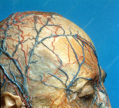 Nerves And Blood Vessels On Scalp Stock Image C0222273 Science