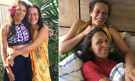 Turia Pitt Explains How Her Mum Taught Her Perseverance Daily Mail