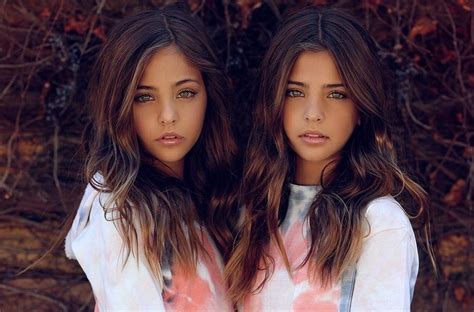 Twins Were Named Most Beautiful In The World