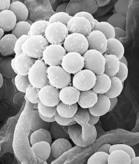 Soil Fungus Trichoderma Sp Photograph By Dennis Kunkel Microscopy My