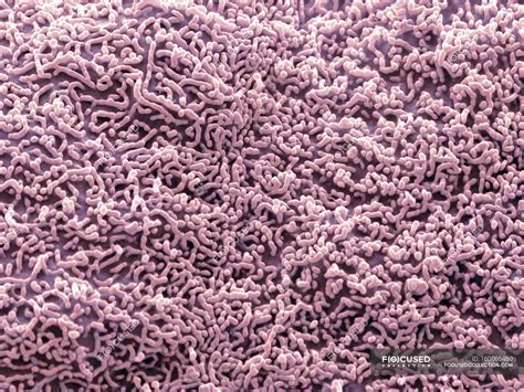 Coloured Scanning Electron Micrograph Sem Of The Surface Of A