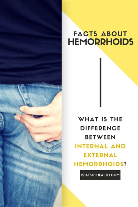 Internal hemorrhoids do not usually have symptoms because of a lack of sensory nerve endings in the rectum. What is the Difference Between an Internal Hemorrhoid and ...
