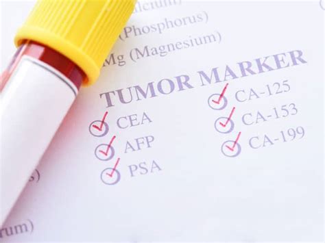 Are Tumor Markers A Cancer Screening Tool Preventive Healthcare