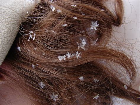 Pixiewinks Snowflakes In Hair By Bowlsofrain Nature Is Full