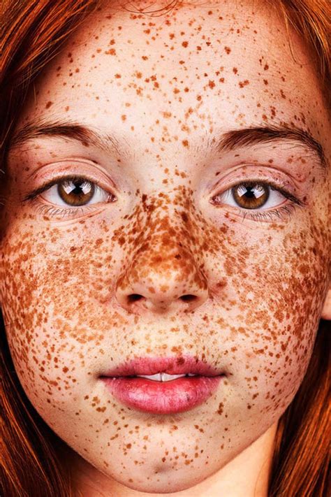 Freckles De Magnifiques Photographies En Hommage Aux Taches De Rousseur Beautiful Freckles