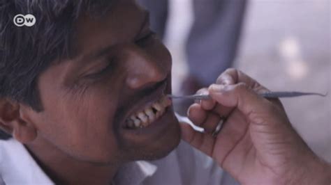 Pakistans Street Dentists Offer Treatment To Poor Dw 10292018